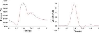 Condiciones al contorno para las simulaciones CFD. Izquierda: pulso de velocidad ...