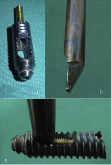 Fig. 1