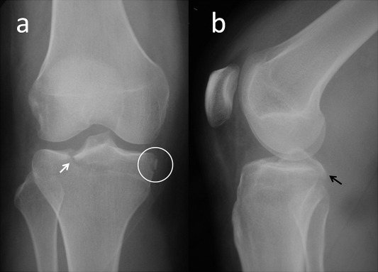 Fig. 1