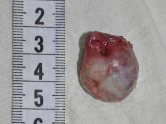 Fig. 4