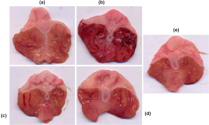 Macroscopic examination of gastric mucosal changes in ethanol and vanillin ...