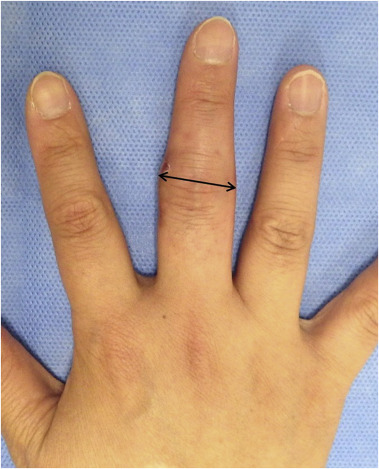 Fig. 2