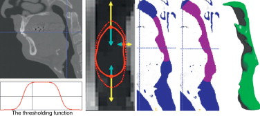 Proceso para restituir volúmenes con un movimiento de avance por las vías aéreas ...