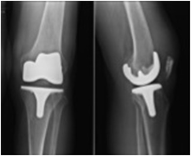 Fig. 5