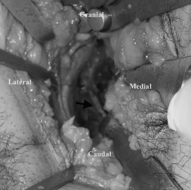 The corona mortis. Dissection and ligation of the corona mortis is important to ...