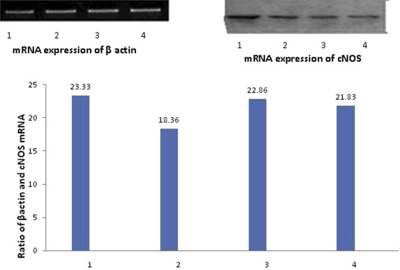 Expression of mRNA for cNOS by reverse transcriptase polymerase chain reaction ...