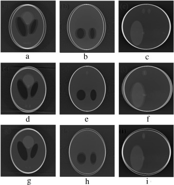 Motion artifacts occurred due to translational varaiation of gradual motion.