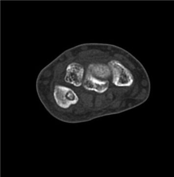 Fig. 2