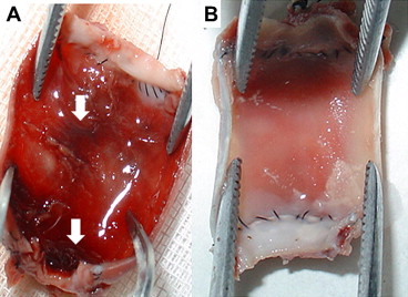 (A) Thrombosis appeared in the luminal surface of one graft. Arrow: thrombosis. ...