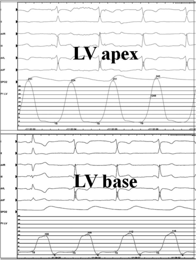 Fig. 2