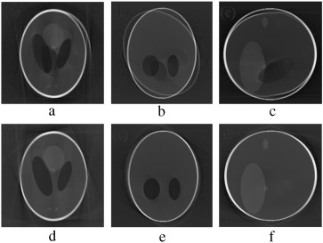 (a–c) Axial, coronal and sagittal slices of the rotational motion corrupted ...