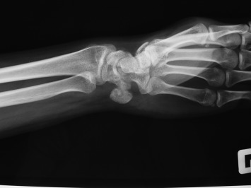 Fig. 1