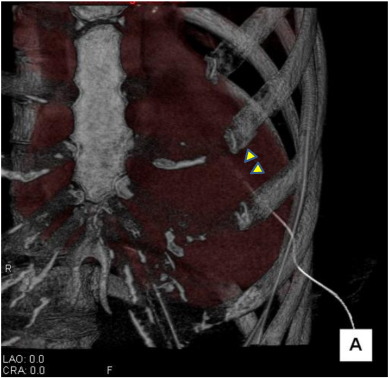Fig. 2