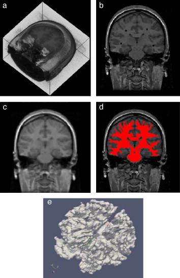 Segmentación de materia blanca empleando Region Growing en IRM del cerebro. (a) ...