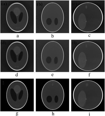 Motion artifacts occurred due to rotational varaiation of gradual motion.