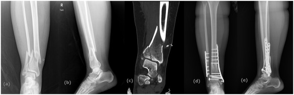 Fig. 2