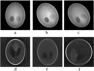 (a–c) Projection at 260°,270° and 280° source position. (d–f) Axial, coronal and ...