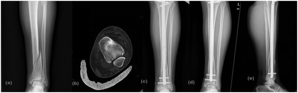 Fig. 1