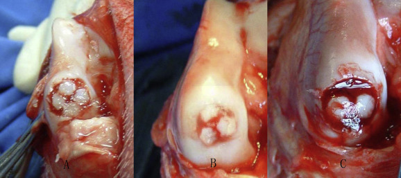 Using the filling of gels of gene transduced bone mesenchymal stem cells (BMSCs) ...
