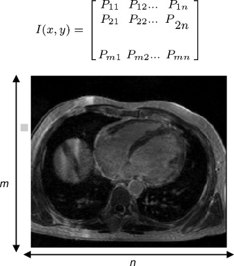 Representación bidimensional de un corte ortogonal de una imagen médica, donde ...