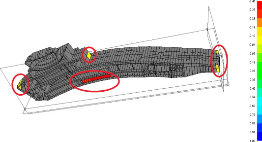 1st Loop structural inadequacy.