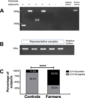 Nested polymerase chain reaction (n-PCR) detection of t(14:18) IGH:BCL2 in DNA ...