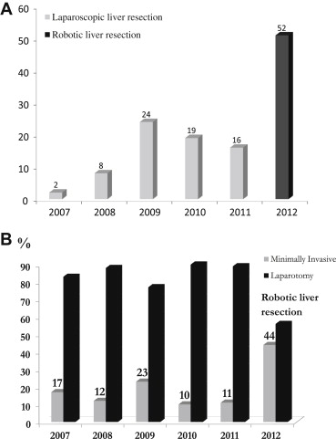 (A) Case number of minimally invasive surgery (MIS) for liver resection. (B) The ...