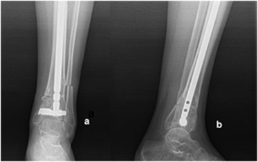 Fig. 6
