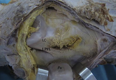 Fig. 1