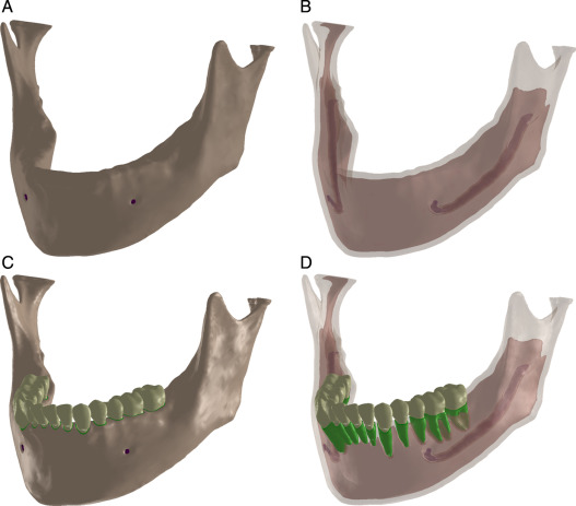 Diferentes vistas dos modelos obtidos. Na parte B e D o osso foi plotado como ...
