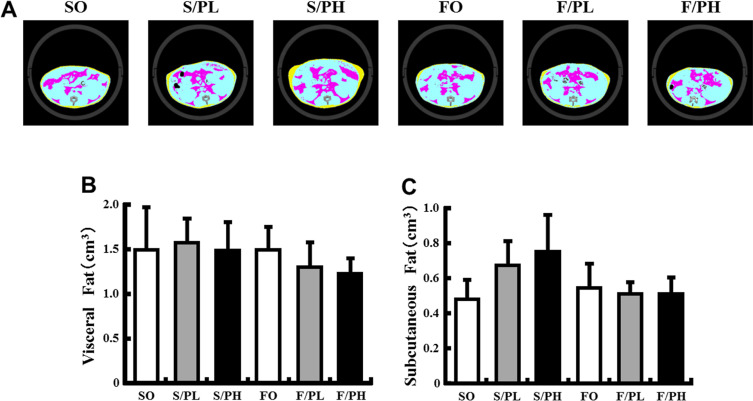 X-ray computed tomography images, visceral fat, and subcutaneous fat in ...