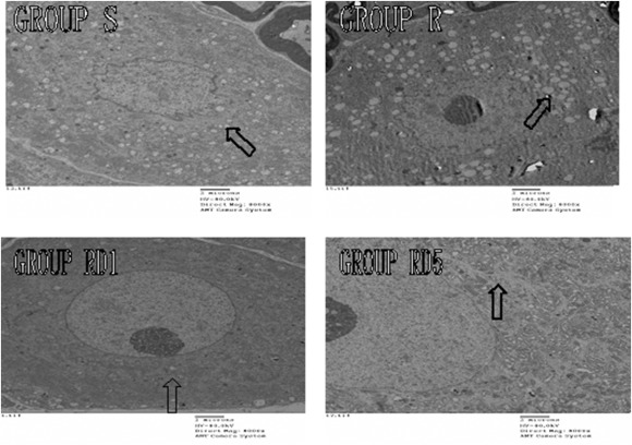 Subcellular structure of dorsal root ganglion (DRG) neurons. The swelling of the ...