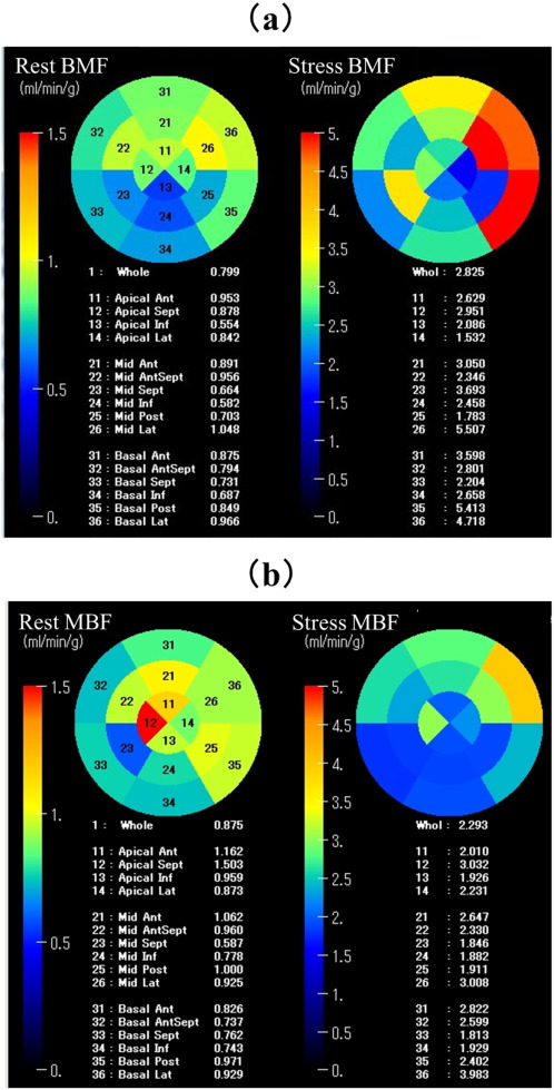 Myocardial blood flow images by 15O-labeled water PET using a 16-segment model ...