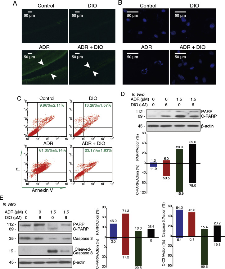 DIO attenuates the ADR-induced human retinal pigment epithelium cells ...