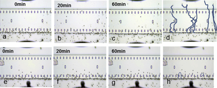 Migration of human eosinophils toward a nasal polyp extract was recorded using ...