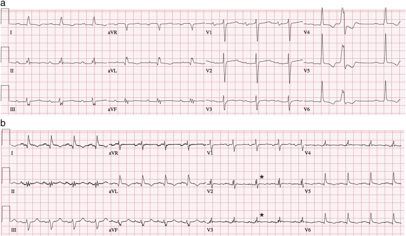 Full-size image (142 K)