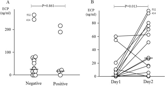 Nasal ECP levels following a single allergen provocation. (A) Nasal ECP levels ...