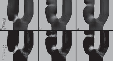 Carótidas idealizadas. Arriba: WSS¯ en Pa. Abajo: TE correspondiente a un WSS ...