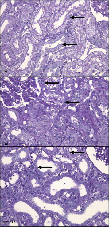 Samples of the microscopic view from the histopathological results of the ...