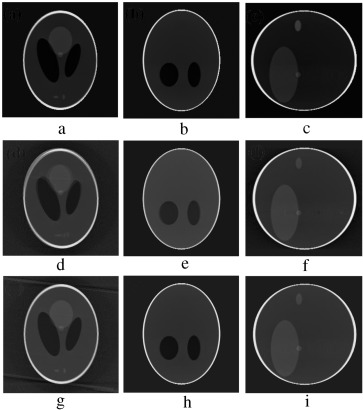 (a–c) Motion-free axial, coronal and sagittal slices. (d–f) Axial, coronal and ...