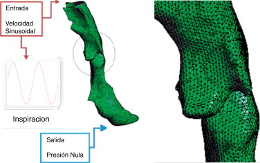 Malla de elementos finitos, detalles y condiciones de contorno.