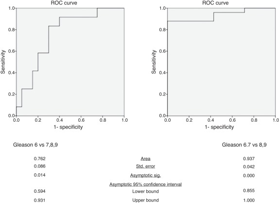 ROC curves of mean ADC in the differentiation of tumors with Gleason score of 6 ...