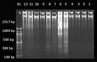 Agarose gel electrophoresis for qualitative estimation of DNA fragmentation in ...