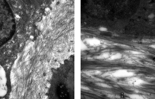 Electron microscope findings 14,500×. A: Group Ir. Collagen fibers composed the ...
