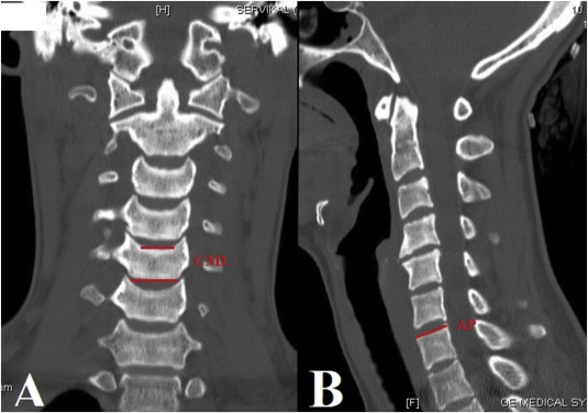Fig. 1