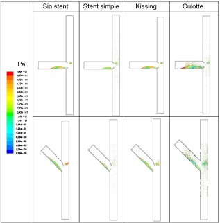 Zonas sometidas a tensiones tangenciales en la pared, promediados en el tiempo, ...