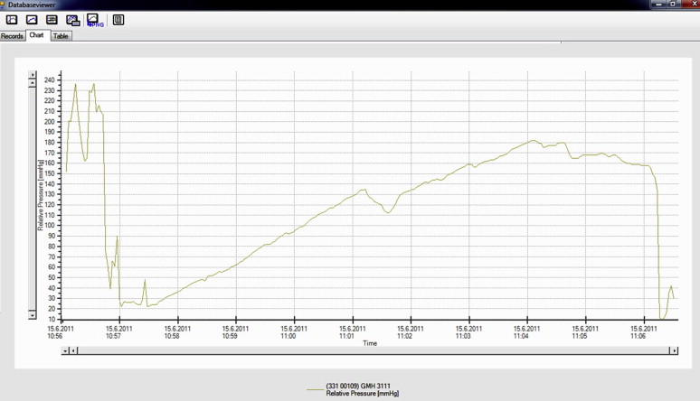 Graphical record depicting the measurement of resistance of the stapled ...