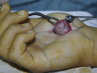 Fig. 3