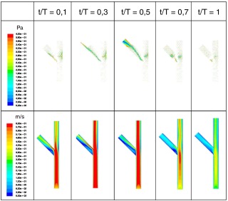 Evolución temporal de las tensiones tangenciales en la pared (imágenes ...