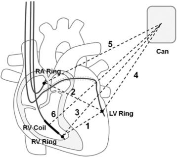 Diagram of CRDT impedance vectors.Electrode configurations used for measuring ...